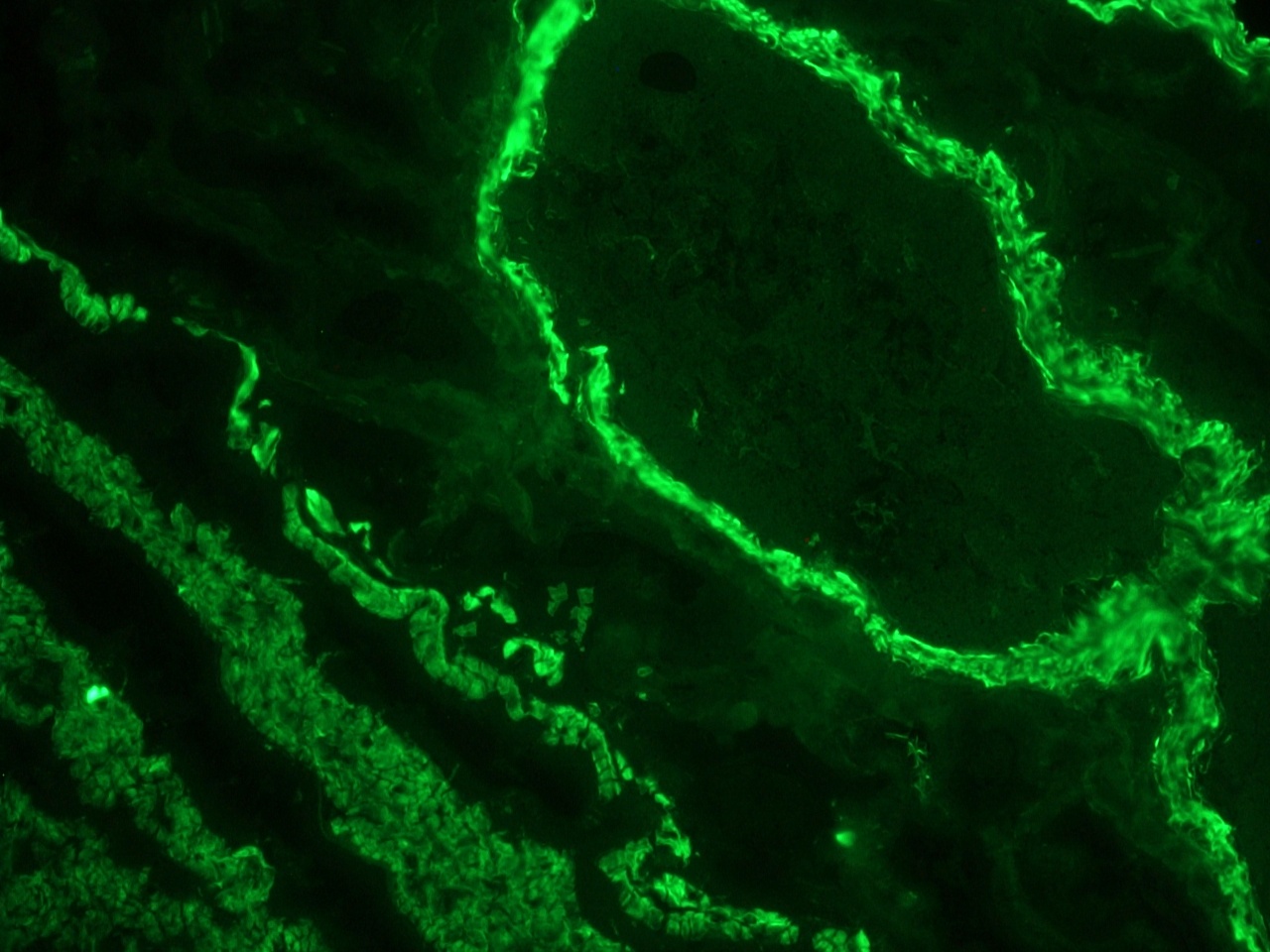 Figure 1. Indirect immunofluoresence staining of a frozen section of human colon using MUB0100P (clone 1A4) showing strong reactivity on the smooth muscle cells at a dilution of 1:500.
